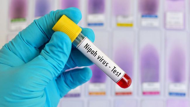 Varian Baru Covid Virus Nipah ‘Super Mematikan’ Ditemukan di India, Indonesia Harus Waspada