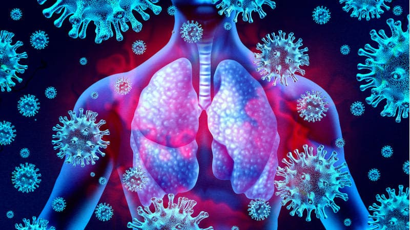 Pencegahan Pneumonia: Tips Sederhana yang Harus Kamu Ketahui
